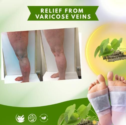 Herbal Giloy Foot Patches – Pack of 2 (20 Pcs) | Relaxation & Wellness Therapy