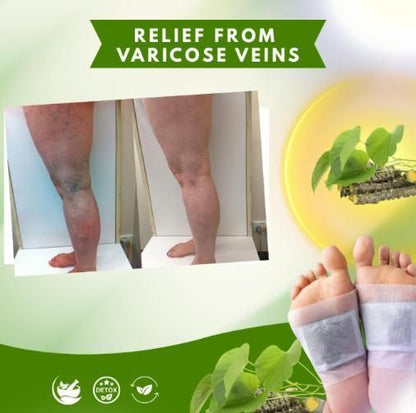 Herbal Giloy Foot Patches – Pack of 2 (20 Pcs) | Relaxation & Wellness Therapy